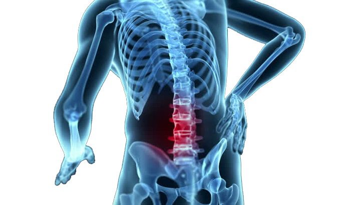 Chiro Treatment in Aurora